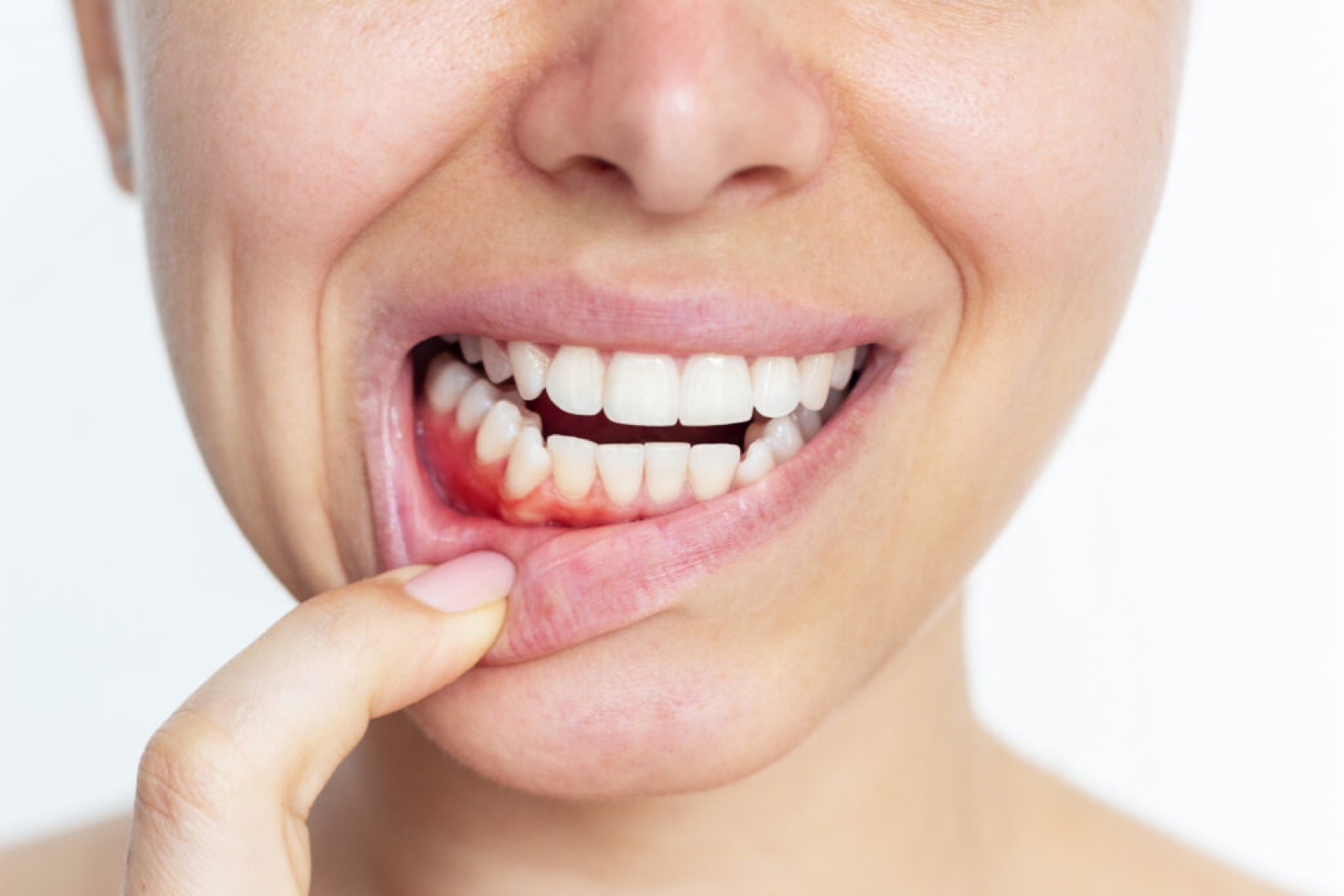 Preventative Care at Greater Brainerd Dental